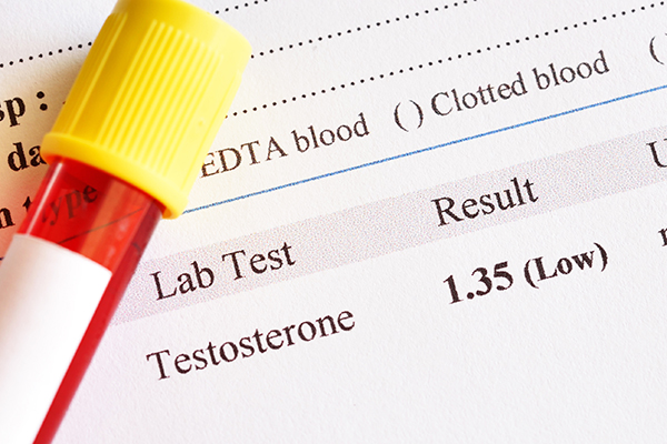 Image of testosterone lab test result